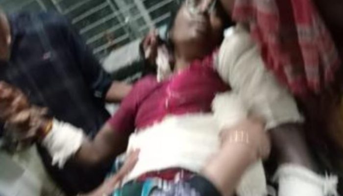 চুয়াডাঙ্গার খাদিমপুরে ভয়াবহ অগ্নিকাণ্ডের ঘটনায় সাক্ষী দেওয়ার অপরাধে বৃদ্ধাকে কুপিয়ে জখম, অভিযুক্ত অপরাধী আটক।